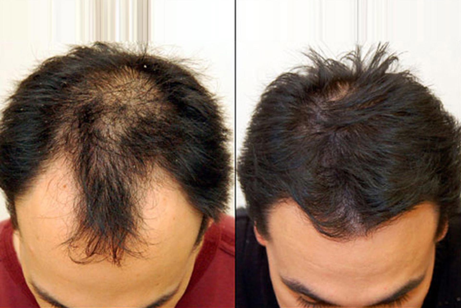 1. Evolvh Better Roots Serum